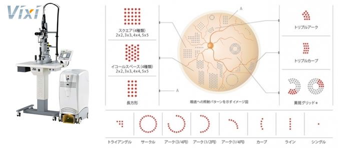 マルチカラースキャンレーザー光凝固装置