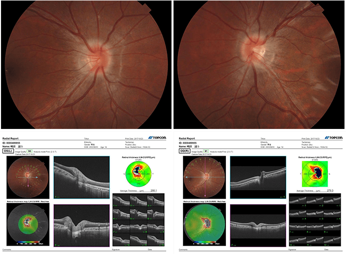 この状態はどのように治療されますか?